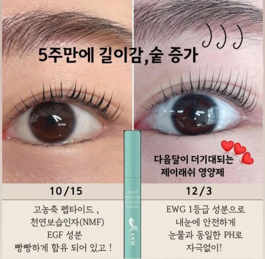네눈에 이미지