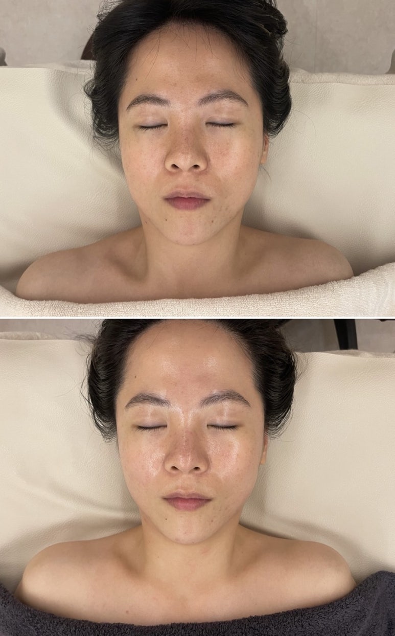 유노에스테틱 이미지