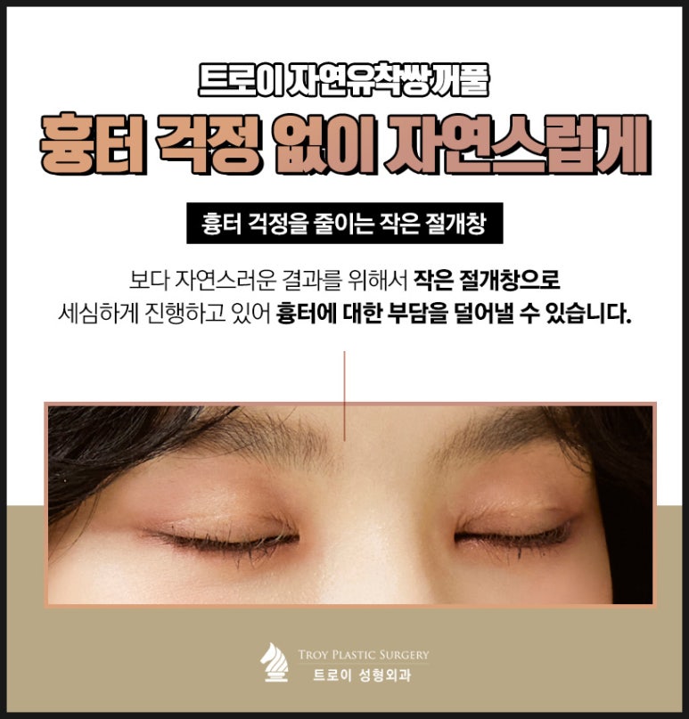 트로이성형외과 이미지