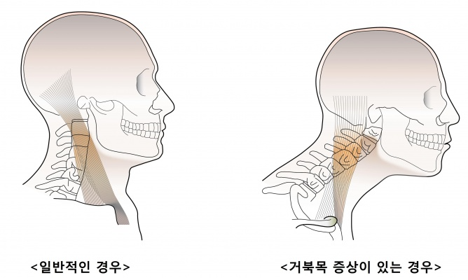 더우아 이미지