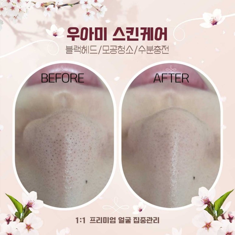 제이드 스킨 & 바디 이미지