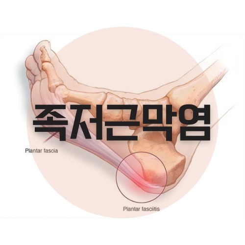 루케테 이미지