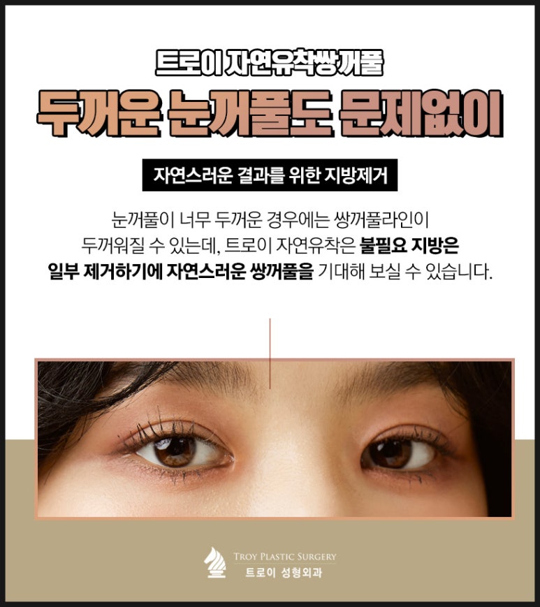 트로이성형외과 이미지