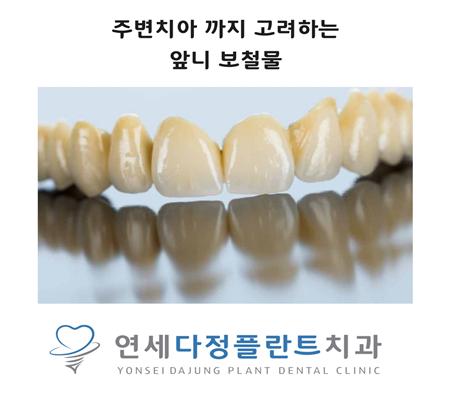 연세다정플란트치과의원 이미지