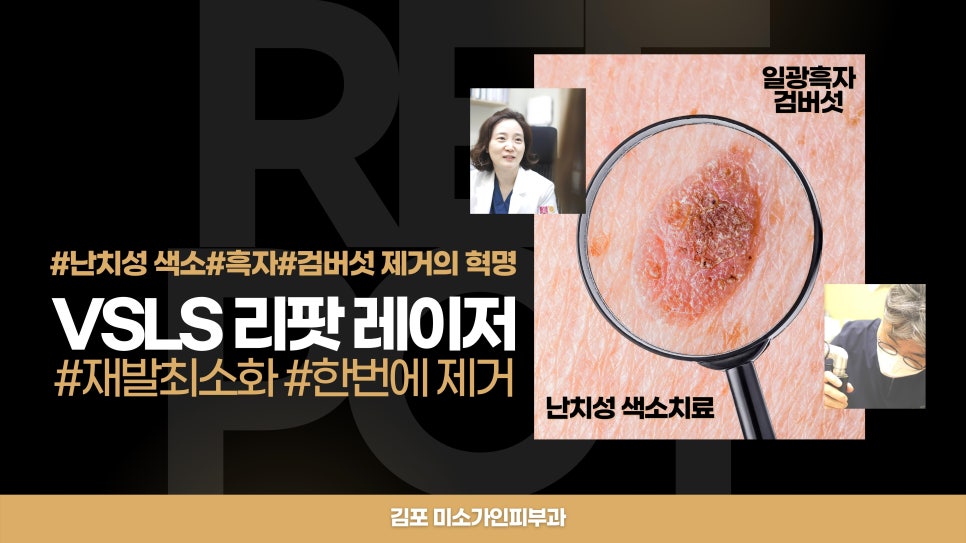 미소가인 이미지
