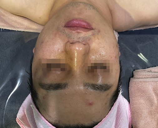 라벨테라피 이미지