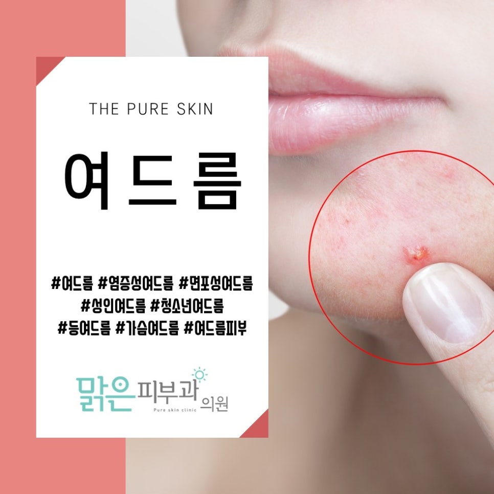 맑은피부과 이미지