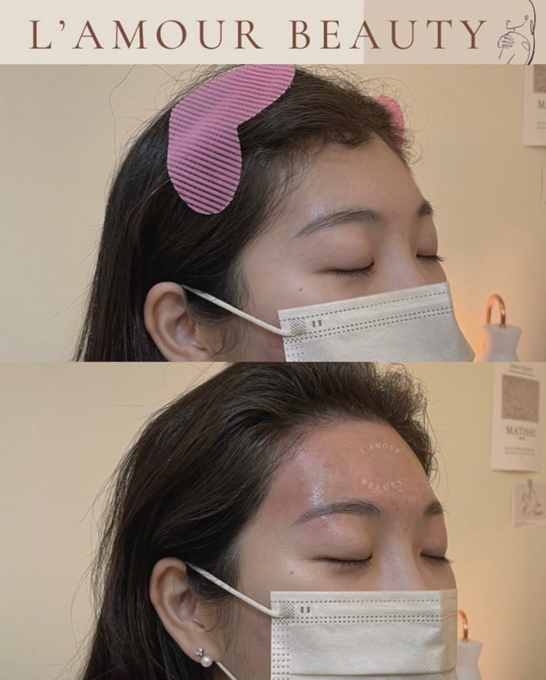 라무르뷰티 이미지