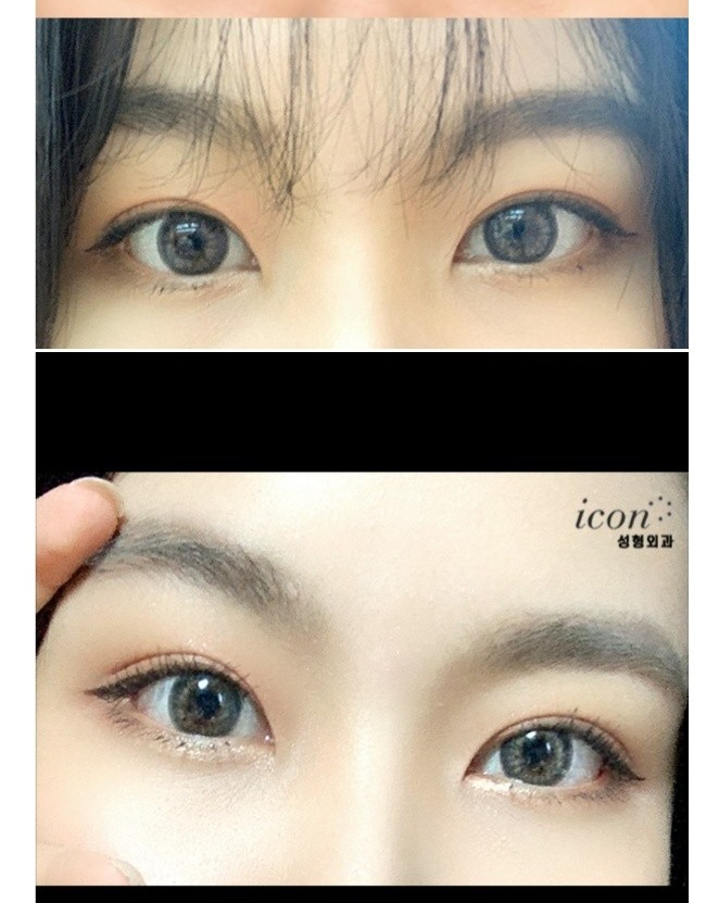 아이그램성형외과 이미지