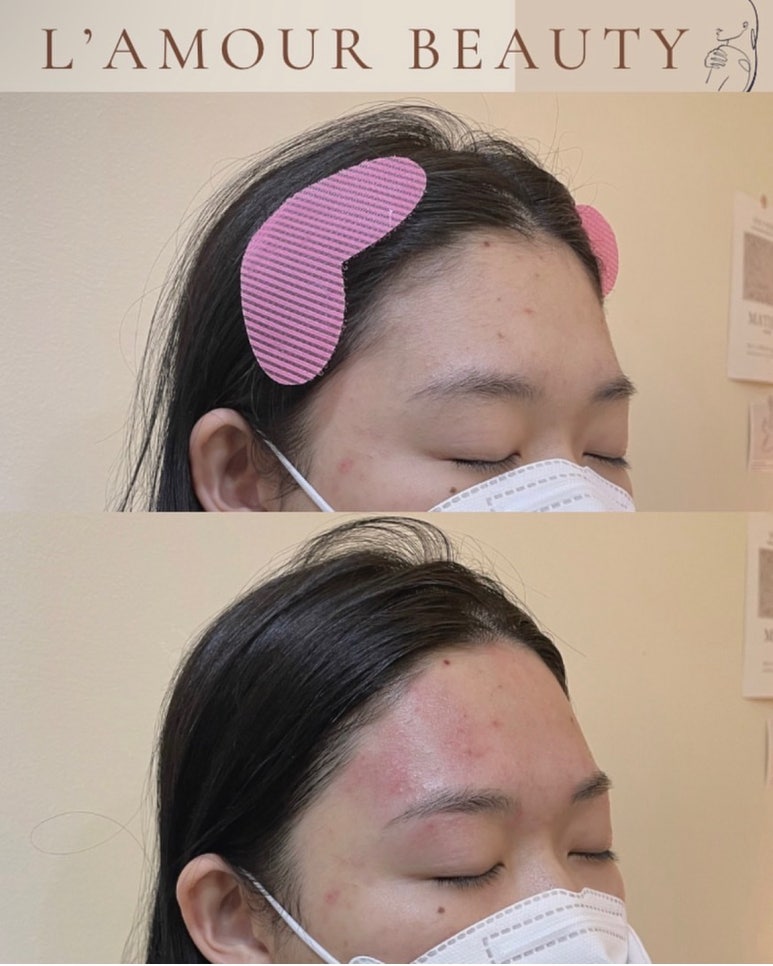 라무르뷰티 이미지