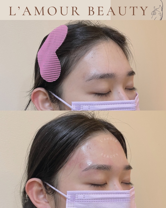 라무르뷰티 이미지