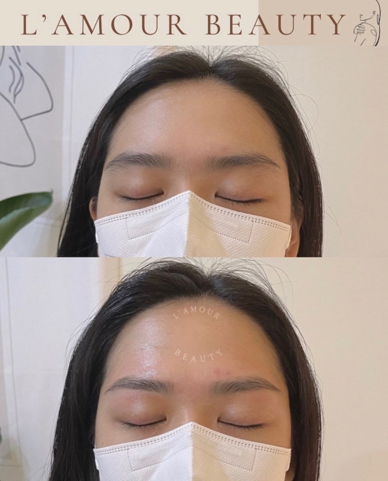 라무르뷰티 이미지