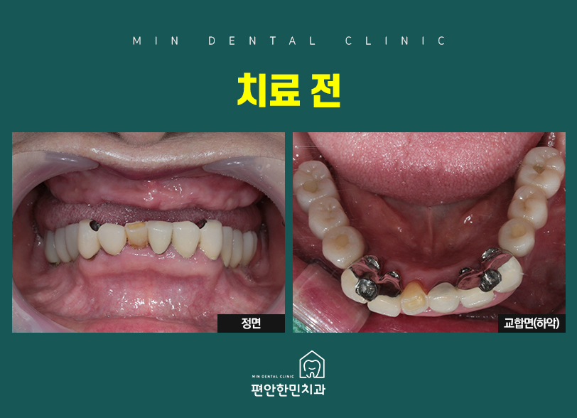 편안한민치과 이미지