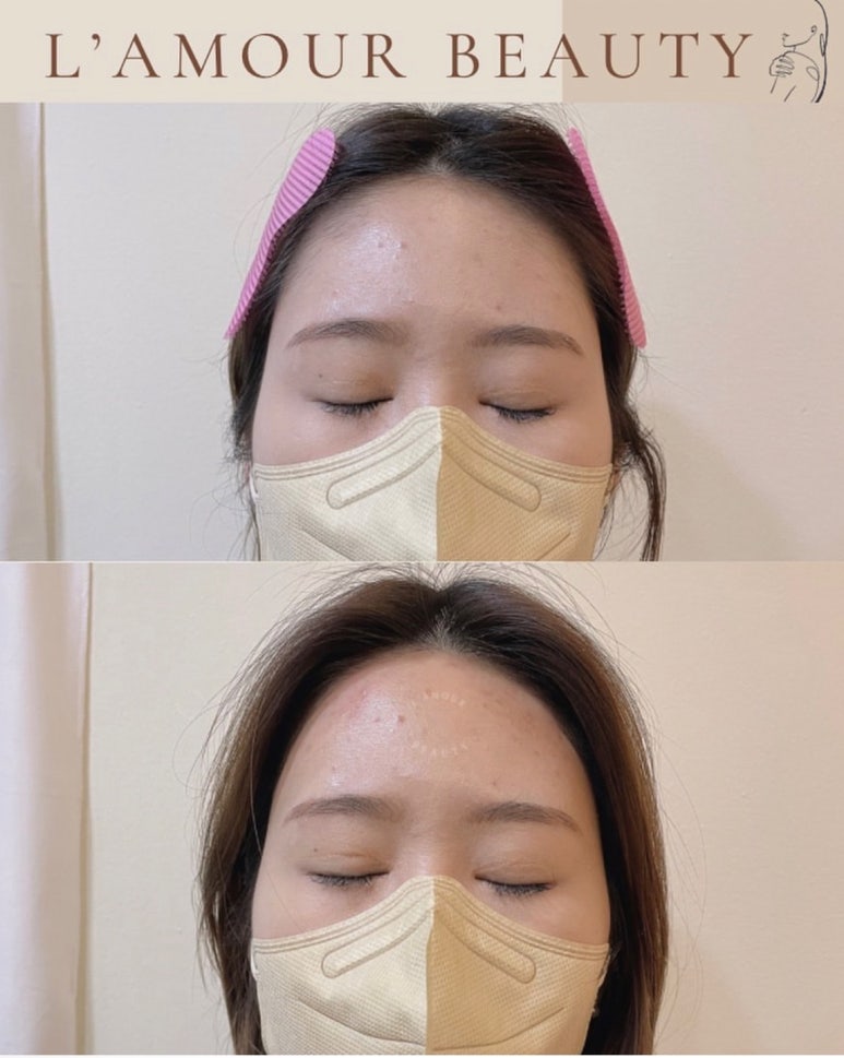 라무르뷰티 이미지