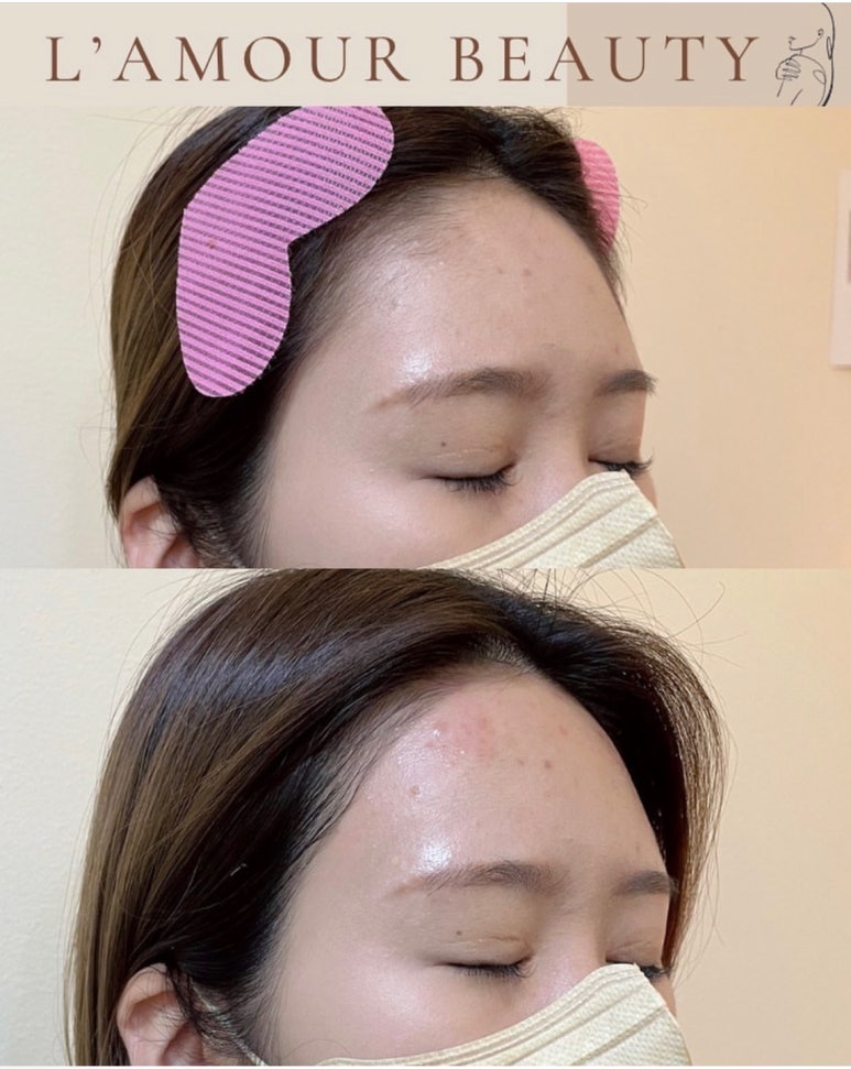 라무르뷰티 이미지