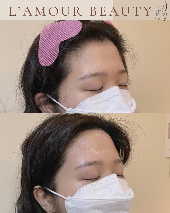 라무르뷰티 이미지
