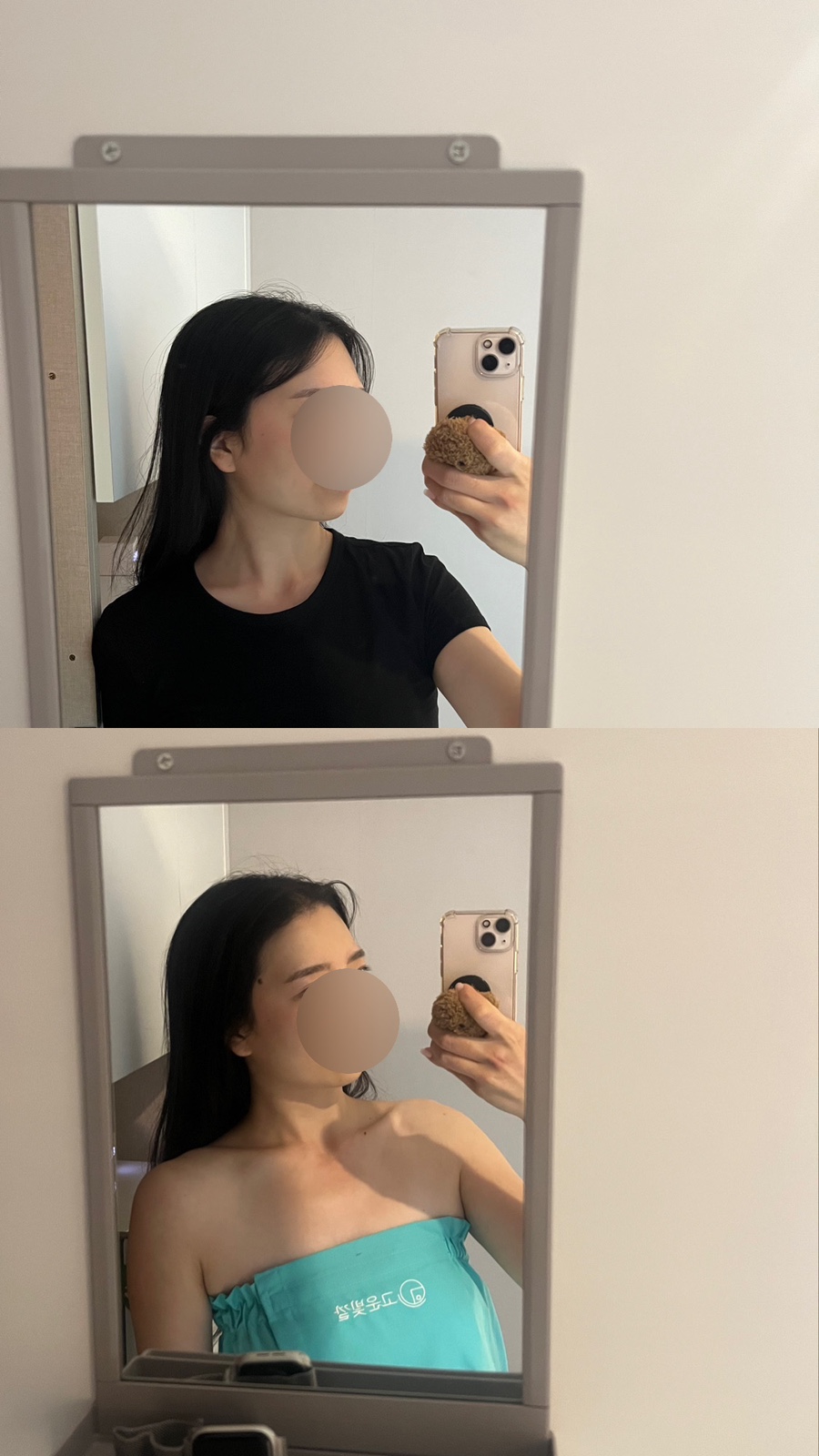 작은얼굴에스테틱 이미지