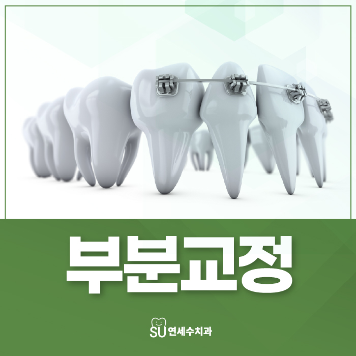 연세수치과 이미지