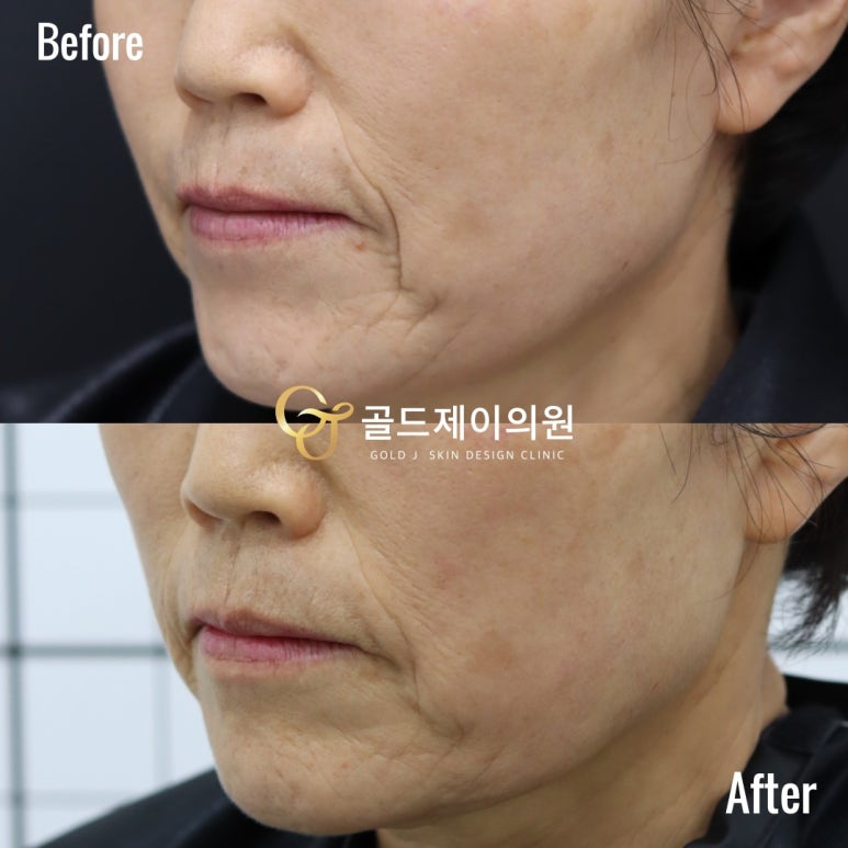 에이지솔루션 이미지