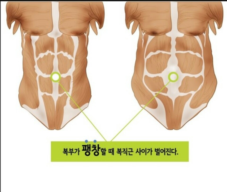 출장마사지 이미지