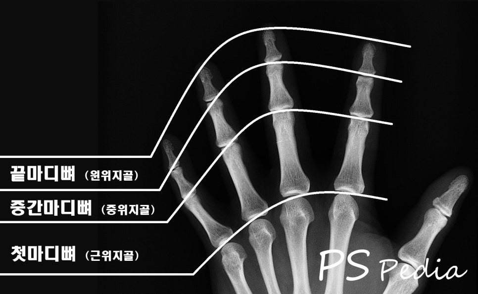 [수부] 수부 해부학 1. 손가락의 뼈 구조 (손가락 뼈 이름) : 네이버 블로그