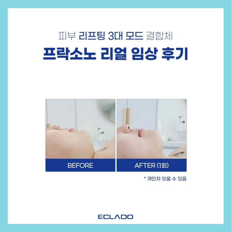 소노뷰티 이미지