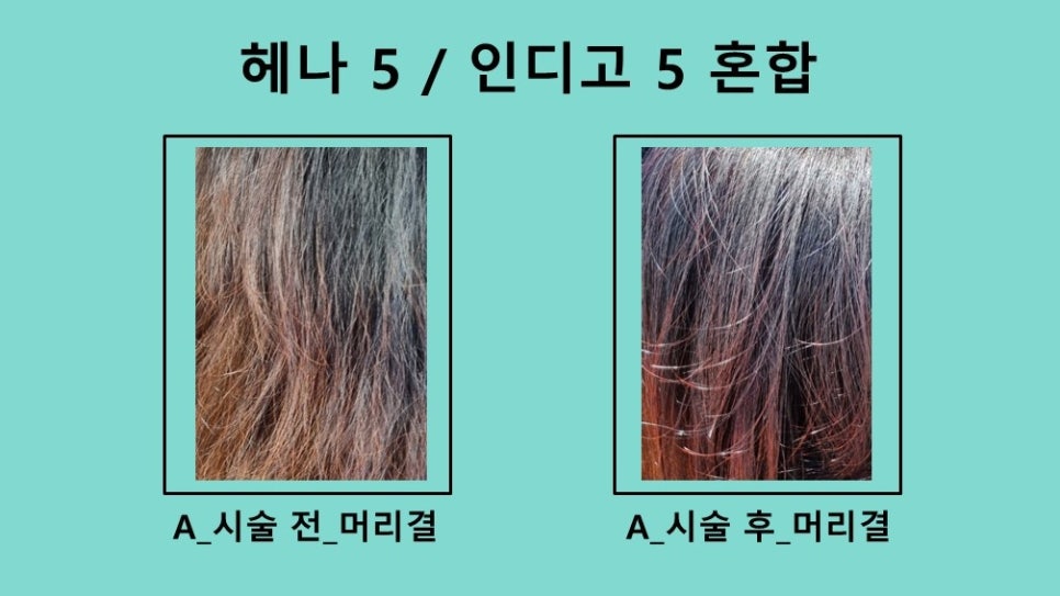 하라힐즈 이미지