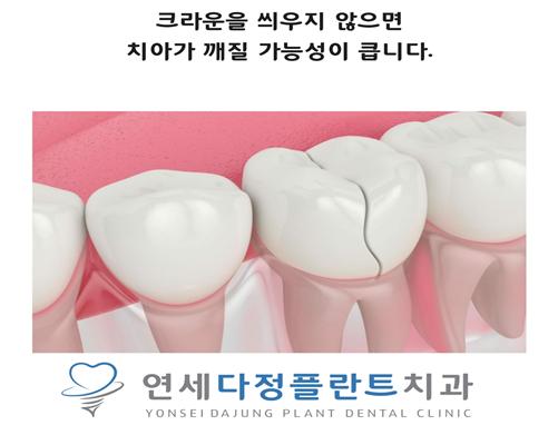연세다정플란트치과의원 이미지