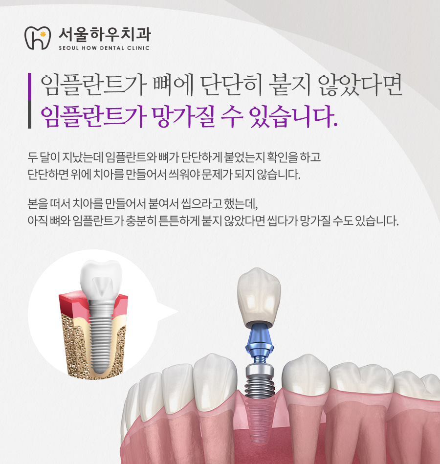 서울하우치과 이미지