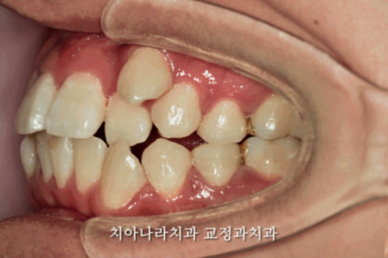나라치과의원 이미지
