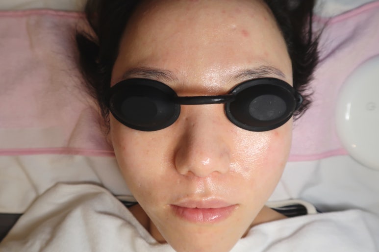 예쁜,날(스킨) 이미지