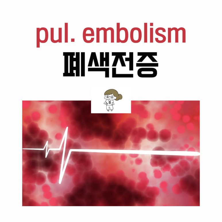 폐 색전증 pulmonary embolism : 네이버 블로그