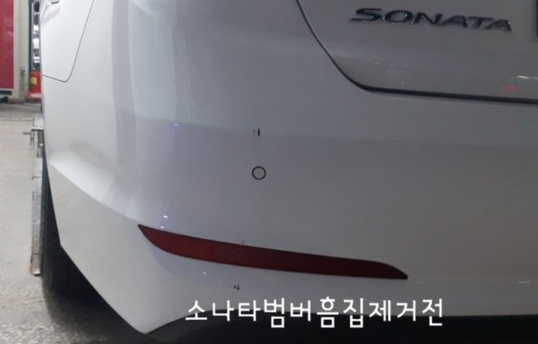 에이스덴트마스터 이미지
