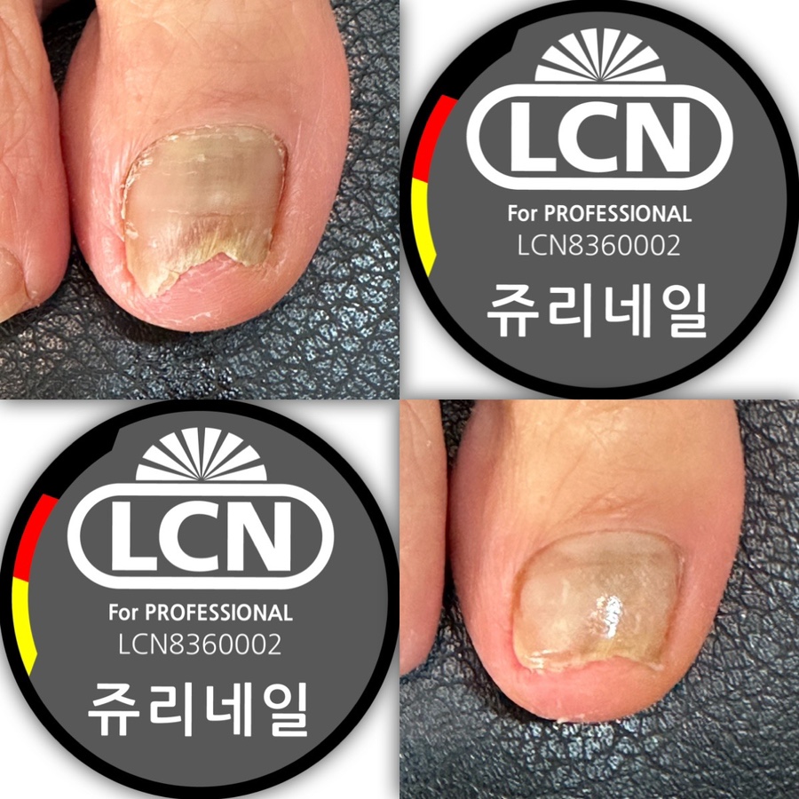 쥬리네일 이미지