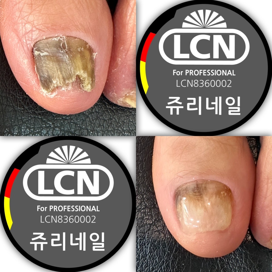 쥬리네일 이미지