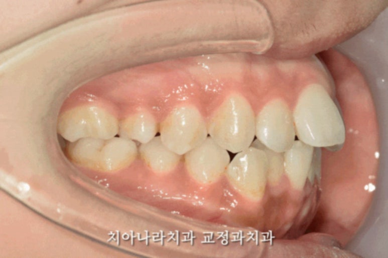 이고치과의원 이미지