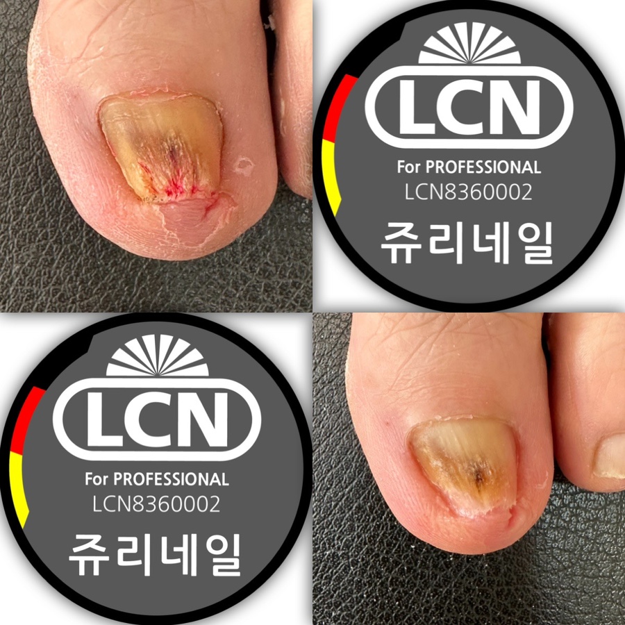 쥬리네일 이미지