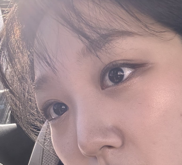 블링수 이미지