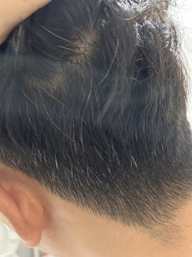 새치와까망머리 이미지