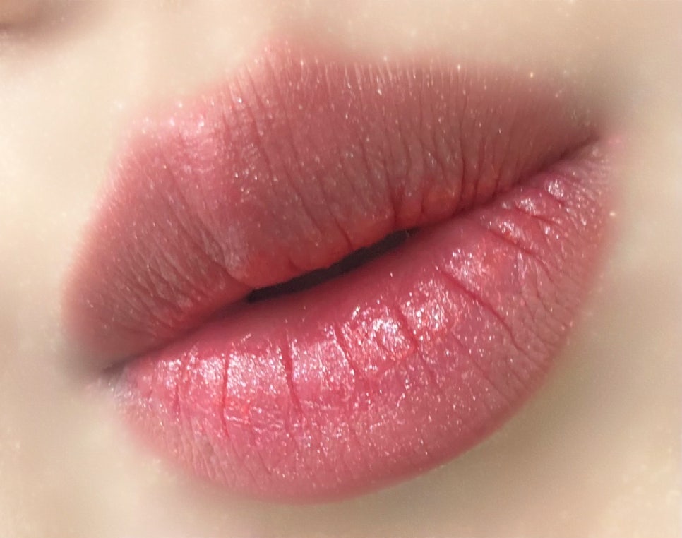 엔비문 이미지