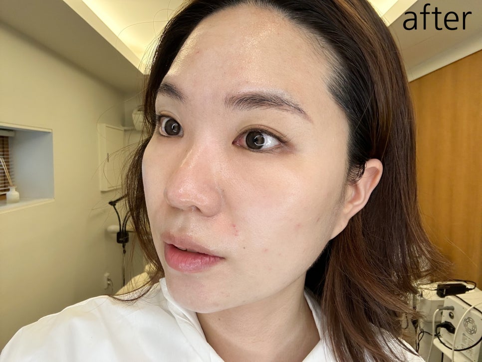 해스테틱 이미지
