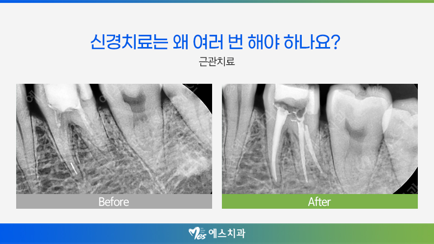예스치과의원 이미지