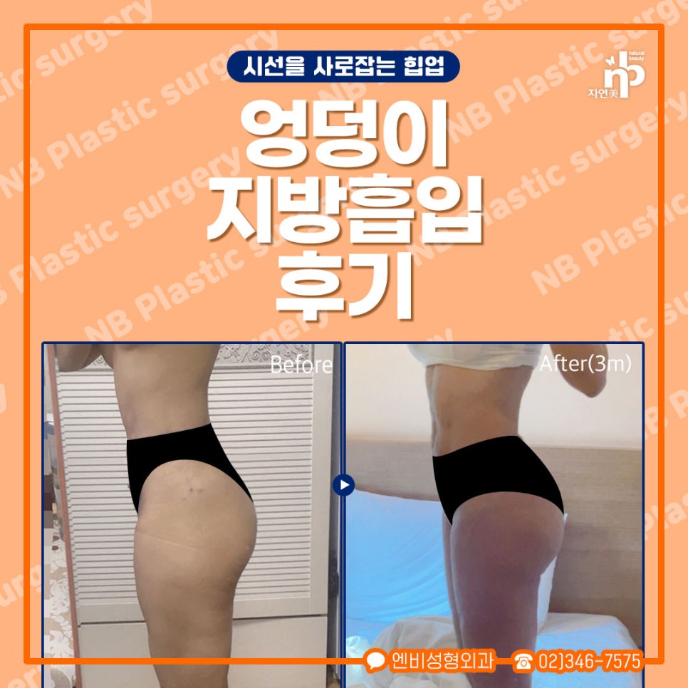 훌륭성형외과 이미지