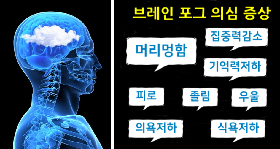 브레인짐 이미지
