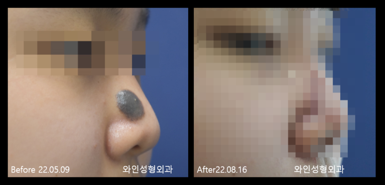 와인성형외과의원 이미지