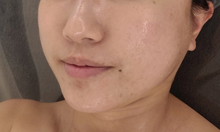 제노필 이미지