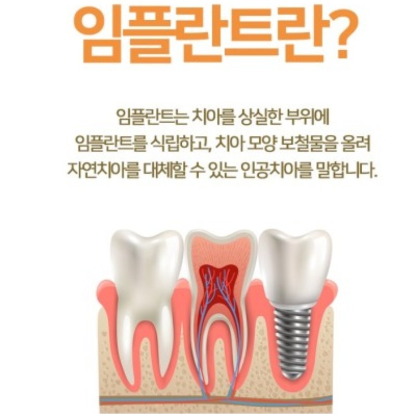 틀치과의원 이미지