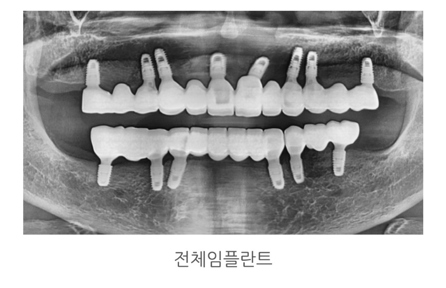 틀치과의원 이미지
