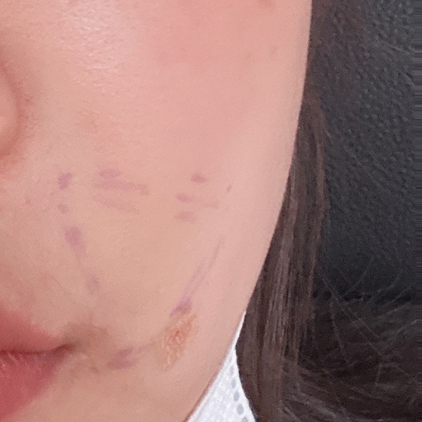황금마사지 피부관리 이미지