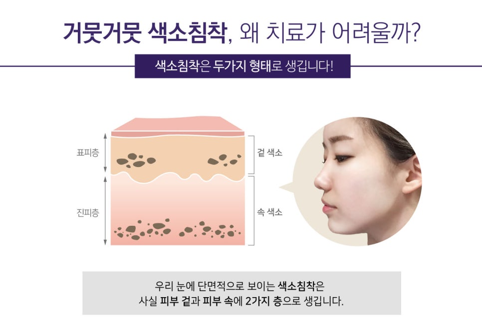 아주고운피부과 이미지
